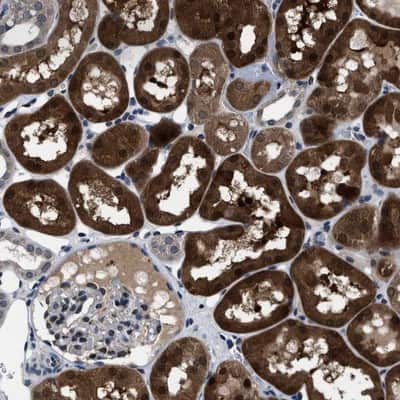 Immunohistochemistry-Paraffin: LRRC14 Antibody [NBP1-81557]