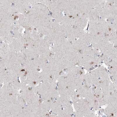 Immunohistochemistry: LRRC14B Antibody [NBP2-32653]