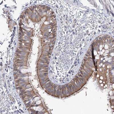 Immunohistochemistry-Paraffin: LRRC14B Antibody [NBP1-90992]