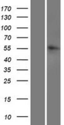 Western Blot: LRRC14B Overexpression Lysate [NBP2-08332]