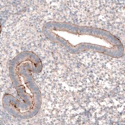 Immunohistochemistry-Paraffin: LRRC15 Antibody [NBP1-93556]