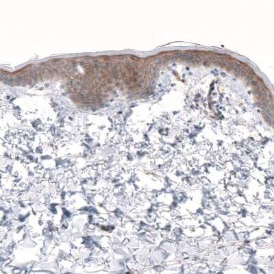 Immunohistochemistry-Paraffin: LRRC15 Antibody [NBP1-93556]