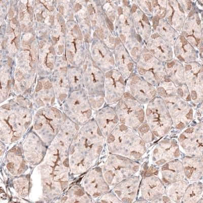 Immunohistochemistry-Paraffin: LRRC15 Antibody [NBP1-93556]