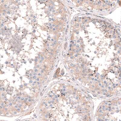 Immunohistochemistry-Paraffin: LRRC15 Antibody [NBP1-93556]