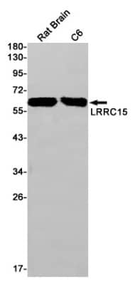 Western Blot: LRRC15 Antibody (S04-3E9) [NBP3-19681]