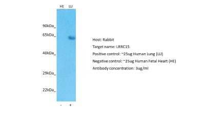 Western Blot: LRRC15 Antibody [NBP1-91365]