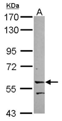 Western Blot: LRRC15 Antibody [NBP2-17166]