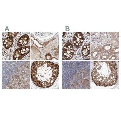 Immunohistochemistry-Paraffin: LRRC16A Antibody [NBP1-91221]