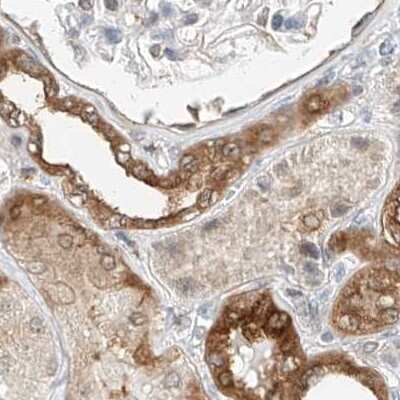 Immunohistochemistry-Paraffin: LRRC16A Antibody [NBP1-91221]