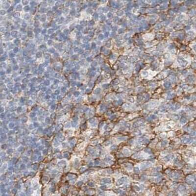 Immunohistochemistry-Paraffin: LRRC16A Antibody [NBP1-91221]