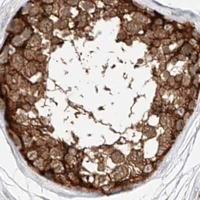 Immunohistochemistry-Paraffin: LRRC16A Antibody [NBP1-91221]