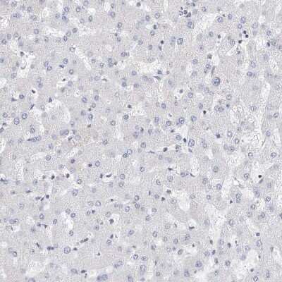 Immunohistochemistry-Paraffin: LRRC16A Antibody [NBP1-91222]