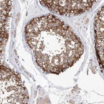 Immunohistochemistry-Paraffin: LRRC16A Antibody [NBP1-91222]