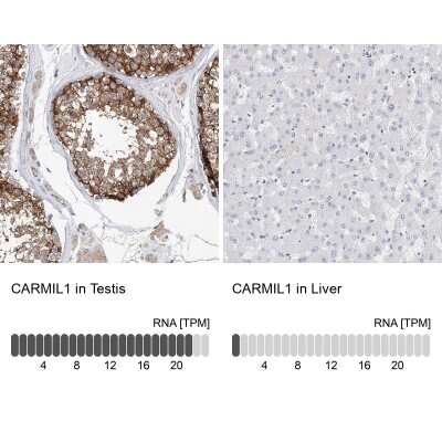 Immunohistochemistry-Paraffin: LRRC16A Antibody [NBP1-91222]