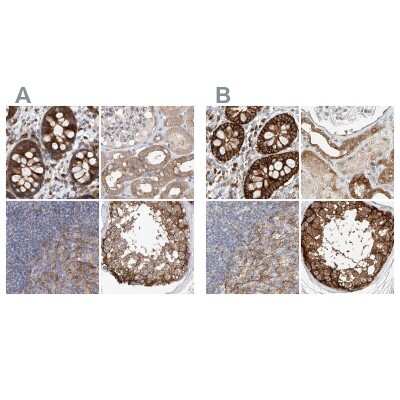 Immunohistochemistry-Paraffin: LRRC16A Antibody [NBP1-91222]