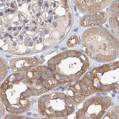 Immunohistochemistry-Paraffin: LRRC16A Antibody [NBP1-91222]