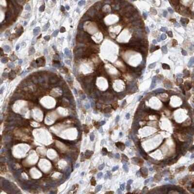 Immunohistochemistry-Paraffin: LRRC16A Antibody [NBP1-91222]