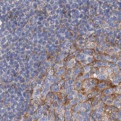 Immunohistochemistry-Paraffin: LRRC16A Antibody [NBP1-91222]