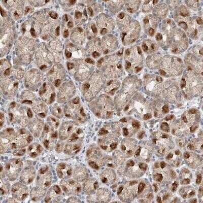 Immunohistochemistry-Paraffin: LRRC16B Antibody [NBP1-88687]