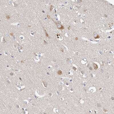 Immunohistochemistry-Paraffin: LRRC16B Antibody [NBP1-88687]