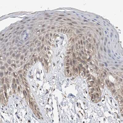 Immunohistochemistry-Paraffin: LRRC16B Antibody [NBP1-88687]