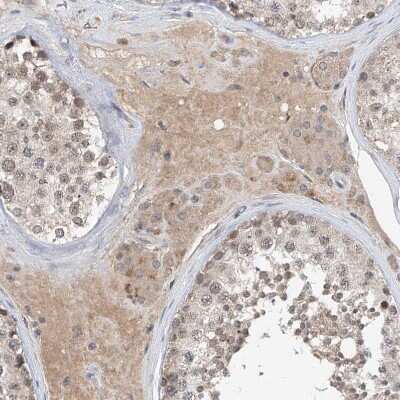 Immunohistochemistry-Paraffin: LRRC16B Antibody [NBP1-88687]