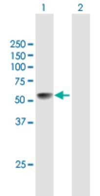 Western Blot: LRRC17 Antibody [H00010234-B01P]