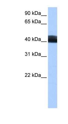 Western Blot: LRRC17 Antibody [NBP1-55529]