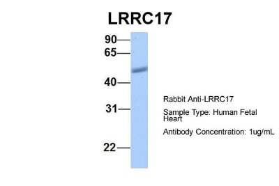 Western Blot: LRRC17 Antibody [NBP1-55529]