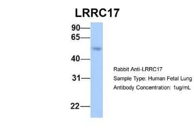 Western Blot: LRRC17 Antibody [NBP1-55529]