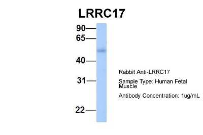 Western Blot: LRRC17 Antibody [NBP1-55529]