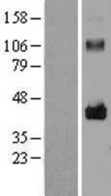 Western Blot: LRRC17 Overexpression Lysate [NBL1-12676]