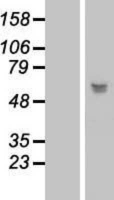 Western Blot: LRRC17 Overexpression Lysate [NBL1-12677]