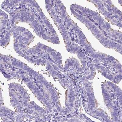 Immunohistochemistry-Paraffin: LRRC18 Antibody [NBP1-81102]