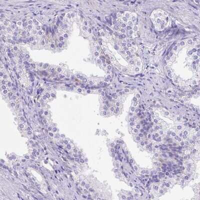 Immunohistochemistry-Paraffin: LRRC18 Antibody [NBP1-81102]