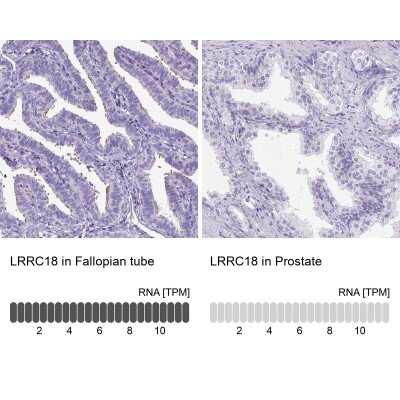 Immunohistochemistry-Paraffin: LRRC18 Antibody [NBP1-81102]