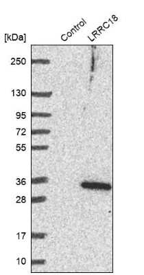 Western Blot: LRRC18 Antibody [NBP1-81102]