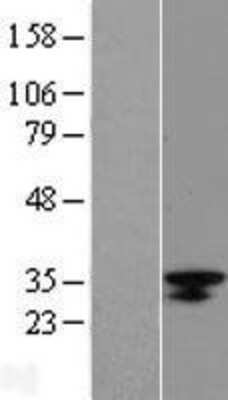 Western Blot: LRRC18 Overexpression Lysate [NBL1-12678]