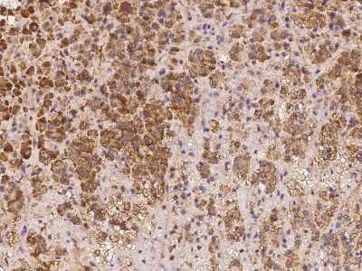 Immunohistochemistry-Paraffin: LRRC19 Antibody [NBP2-97212]