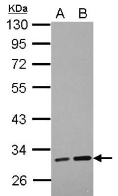 Western Blot: LRRC19 Antibody [NBP2-17167]