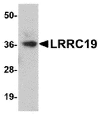 Western Blot: LRRC19 AntibodyBSA Free [NBP2-81732]