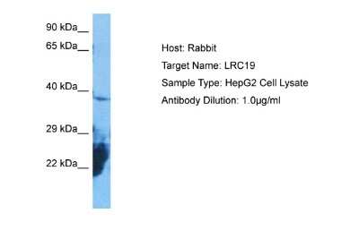 Western Blot: LRRC19 Antibody [NBP2-84147]