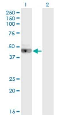 Western Blot: LRRC2 Antibody (1G3) [H00079442-M02]