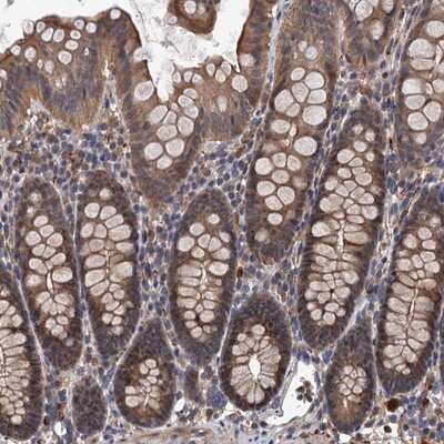 Immunohistochemistry-Paraffin: LRRC2 Antibody [NBP1-85853]