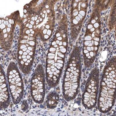 Immunohistochemistry-Paraffin: LRRC2 Antibody [NBP1-86250]