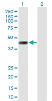 Western Blot: LRRC2 Antibody [H00079442-B01P]