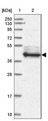 Western Blot: LRRC2 Antibody [NBP1-85853]