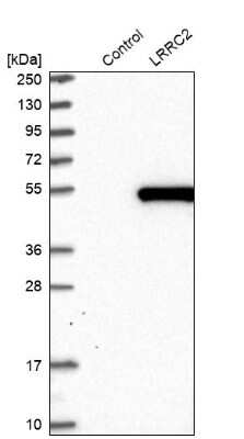 Western Blot: LRRC2 Antibody [NBP1-86250]