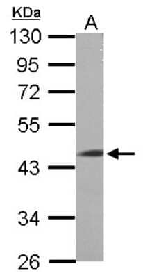 Western Blot: LRRC2 Antibody [NBP2-19374]