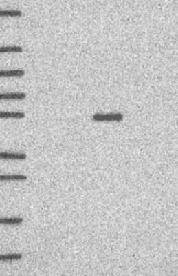 Western Blot: LRRC2 Antibody [NBP3-17881]